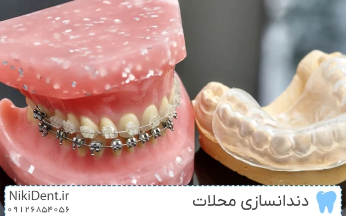 دندانسازی-محلات