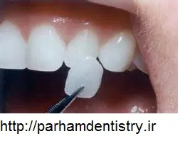 خدمات-برتر-دندانپزشکی