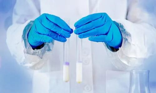 آزمون-تعیین-بار-میکروبی