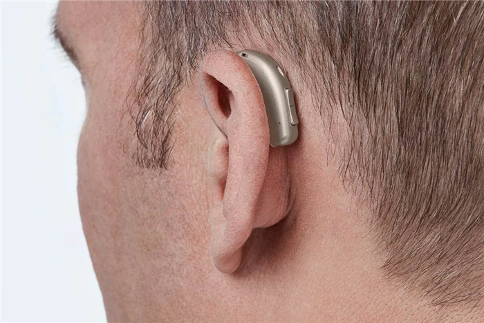 خرید-سمعک-نامرئی-از-کلینیک-شنوایی-و-سمعک-پاسارگ