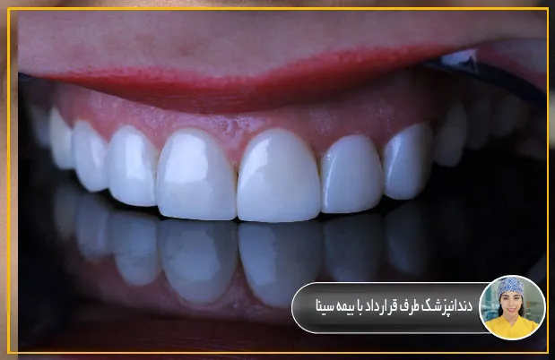 دندانپزشک-طرف-قرارداد-با-بیمه-سینا