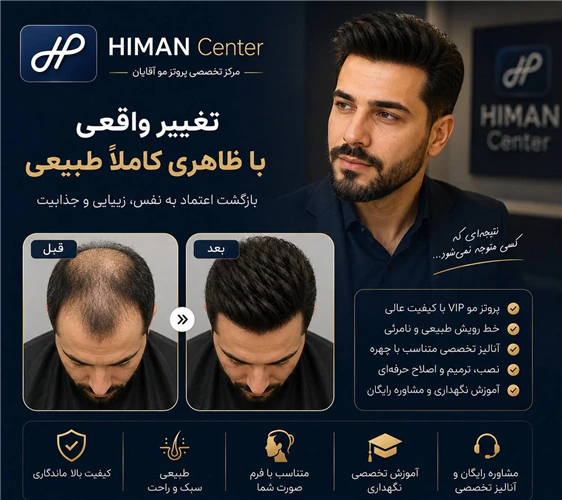 پروتز-مو-مردانه-اصفهان