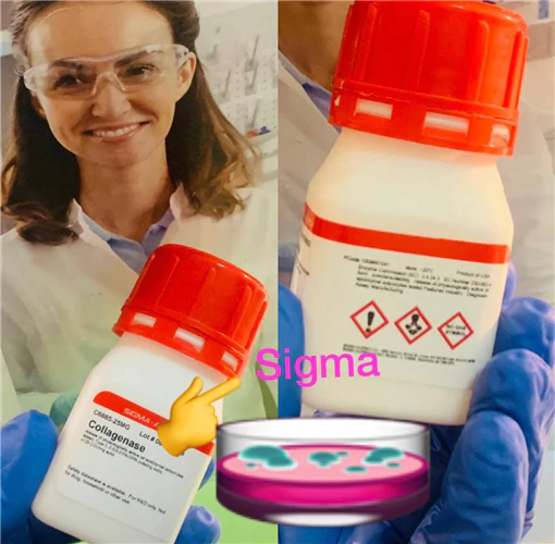 کلاژناز-sigma