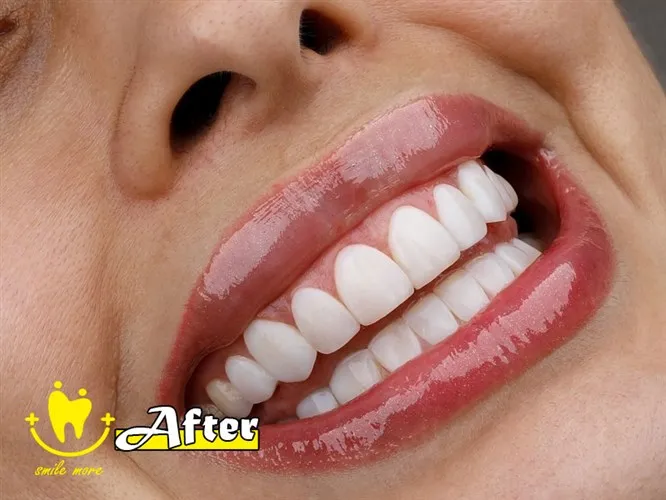 بهترین-دندانپزشک-تهران