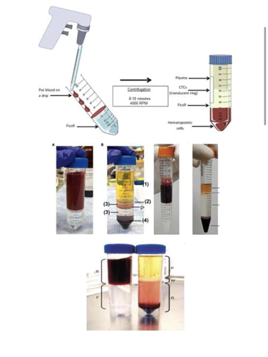 محلول-فایکول-lymphodex