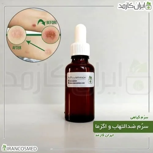 سرم-ضدالتهاب-و-تسکین-اگزما-برند-irancosmed