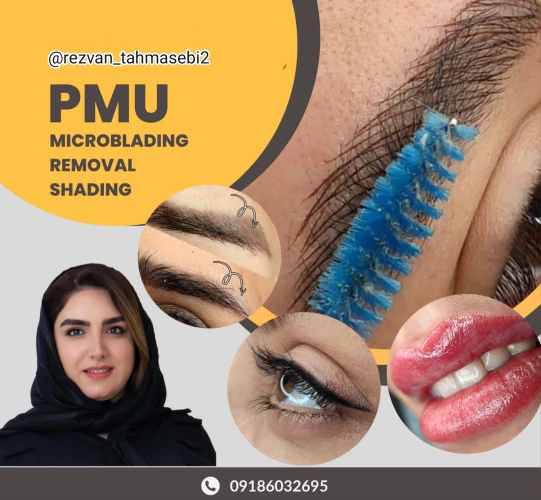 میکروبلیدینگ-و-شیدینگ-در-اراک--رضوان-طهماسبی-ط