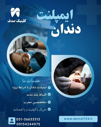 ایمپلنت-دندان-در-مشهد-–-از-دم-قسط-بدون-سود-و-ب