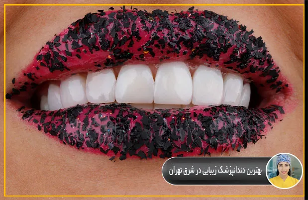 بهترين-دندانپزشك-زيبايي-در-شرق-تهران