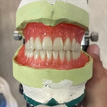  ساخت انواع دندان مصنوعی